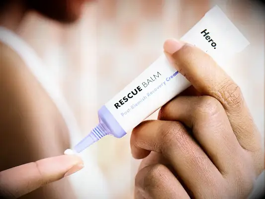 Hero Rescue Balm for pimple recovery